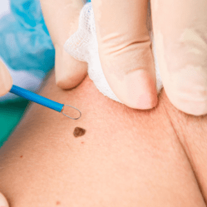 dermatologie sector 6