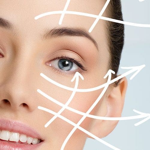 Toxina Botulinica botox 01