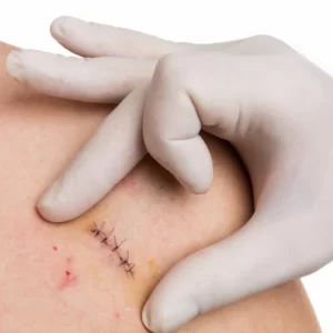 dermatologie sector 6