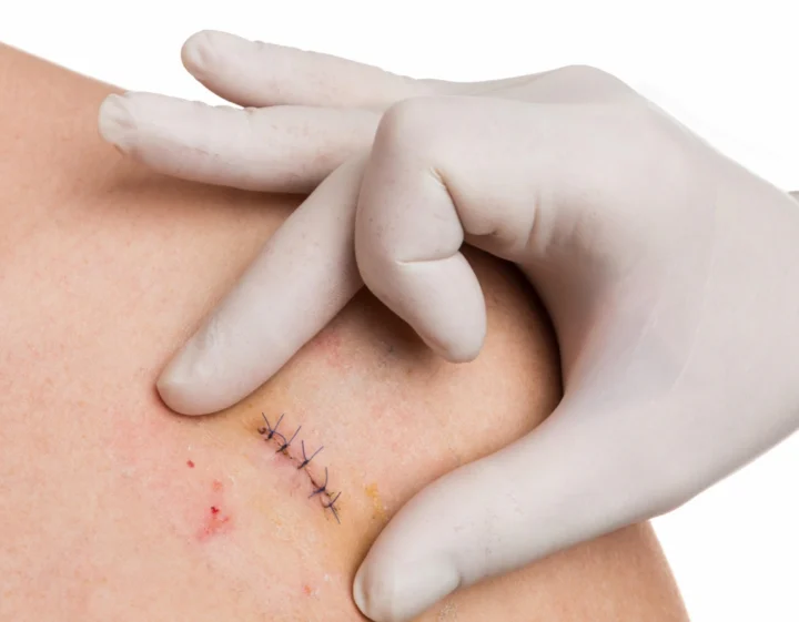 dermatologie sector 6